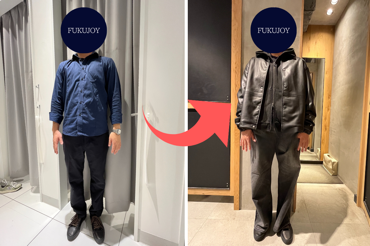 【Before/After】26歳/男性/東京